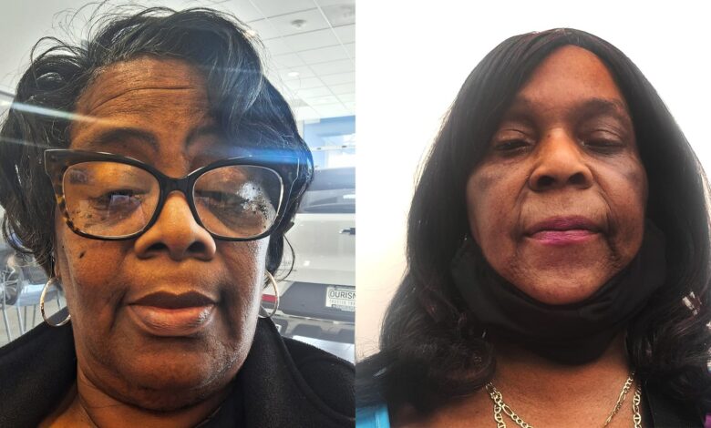65-year-old furloughed by government shutdown: ‘I could lose everything’